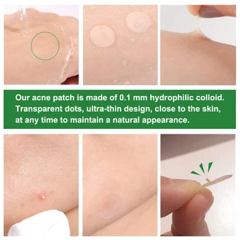 24pcs Ultra-tanek Akne Mozoljem Odstranjevalec Obliži za Zdravljenje Aken, Nalepke Kit Blemish Spot za Nego Kože, Nego Obraza, Orodje