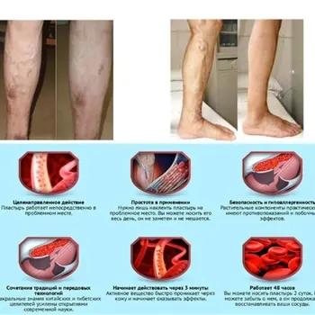 Tele Stiskanje Rokavi Noge Stiskanje Nogavice za Shin Opornica Tele Lajšanje Bolečin Moški Ženske Rokav za Tek, Kolesarjenje